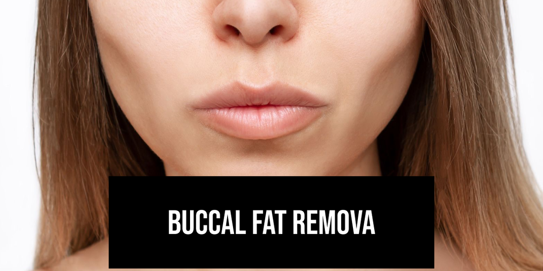 Buccal Fat Removal