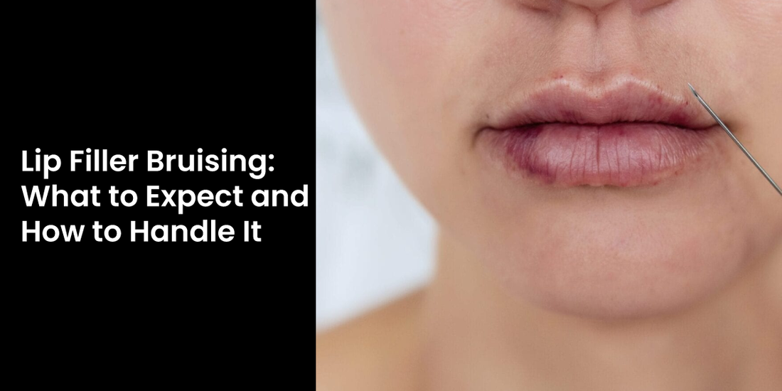 Lip Filler Bruising: What to Expect and How to Handle It