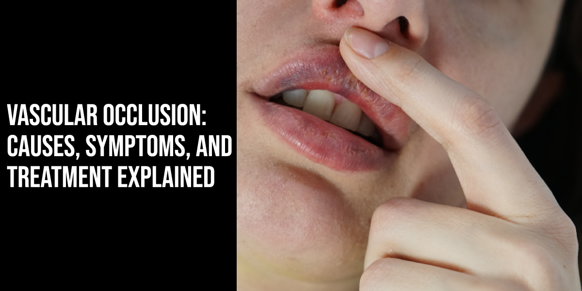 Vascular Occlusion